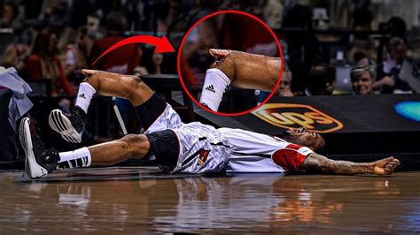 don best nba injuries.